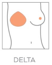 amoena delta breast shaper