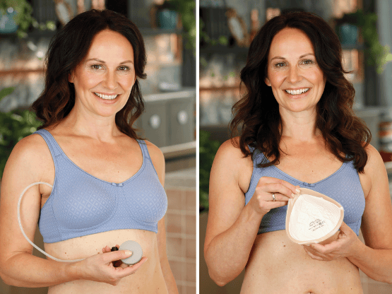 Barbara's Decision to Wear Breast Prostheses After Double Mastectomy