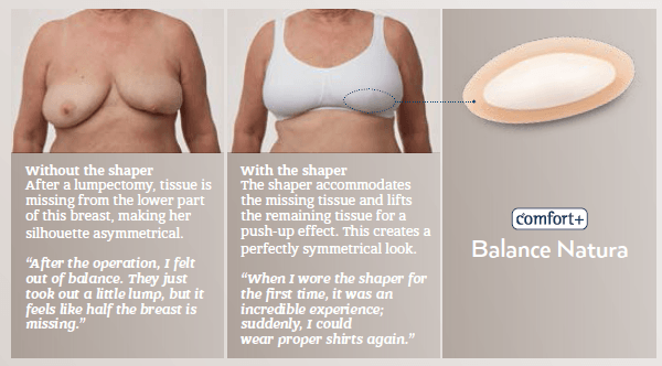 lumpectomy pictures breast prosthesis 