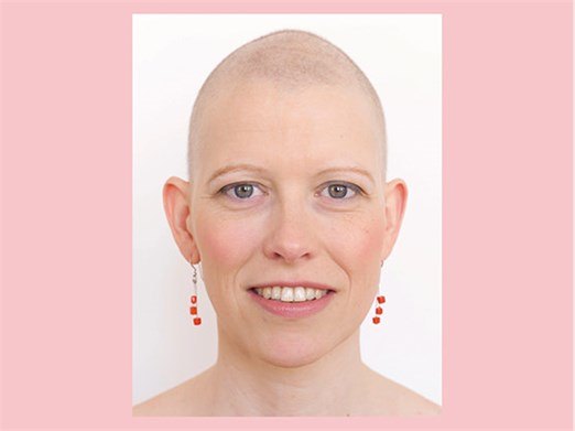 „Beide Brüste müssen ab“