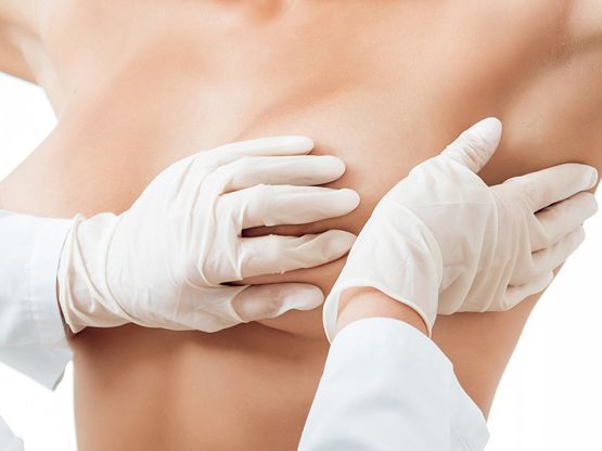 Brustrekonstruktion oder nicht