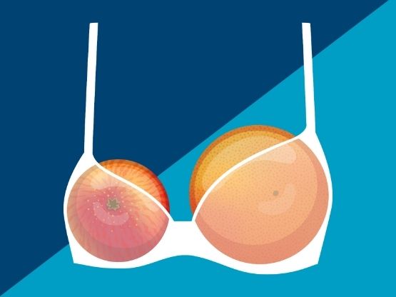 Amoena Worldwide | Amoena Bras, Swimwear, Breast Forms, Prosthesis,  Lingerie, &amp; Mastectomy Wear