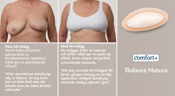 Bilder delproteser för bröstbevarande operation