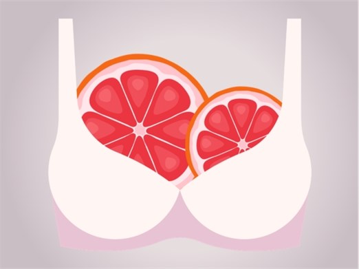 What Is Breast Asymmetry? Causes and What's Normal