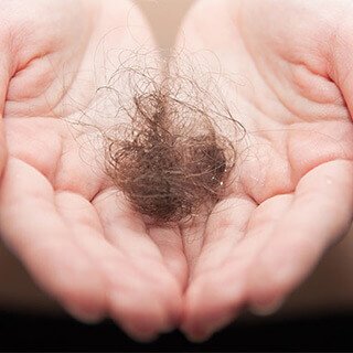 Dealing with Hair Loss