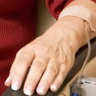 IV Access Care During Chemo
