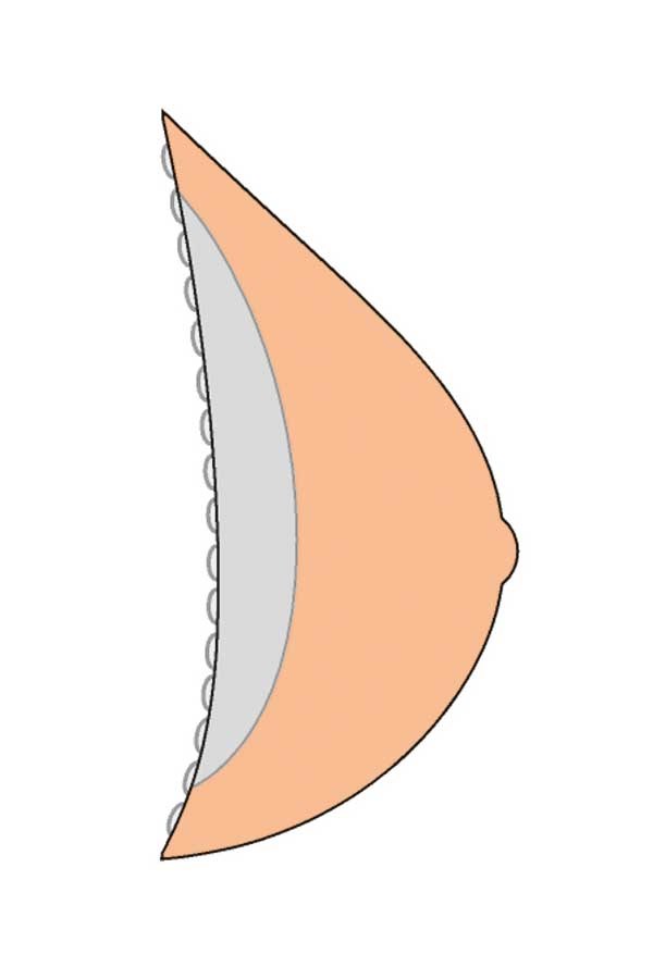 Buy Contact Light 3S Breast Form - ivory | Amoena Canada