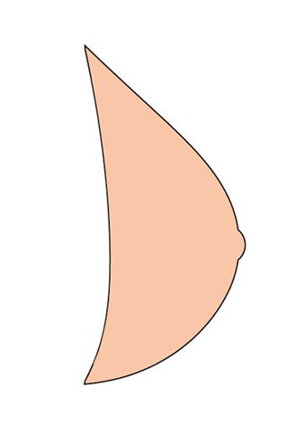 Essential Light 2S 442T Breast Form