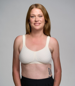 ungleiche Brust, mit Teilbrustprothese