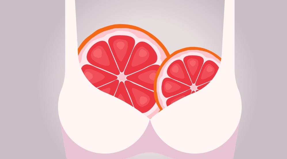 What is breast asymmetry